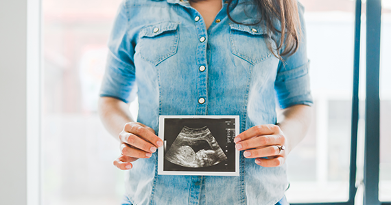 Una mujer tiene una ecografía delante de ella, lo que significa que está embarazada recientemente y tendrá que cambiar sus beneficios